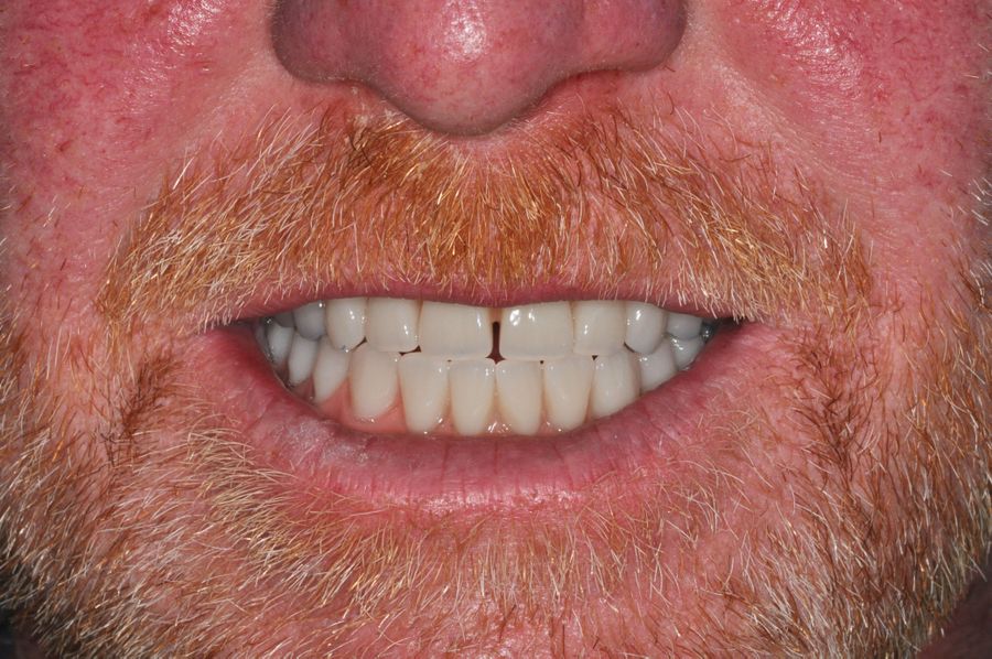 smile in a day 9 after